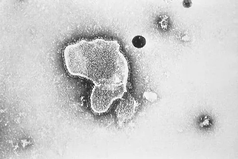 respiratory syncytial virus: any virus in genus Pneumovirus causing respiratory tract infections