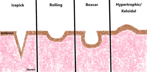 rolling: drunk; intoxicated from alcohol, staggering