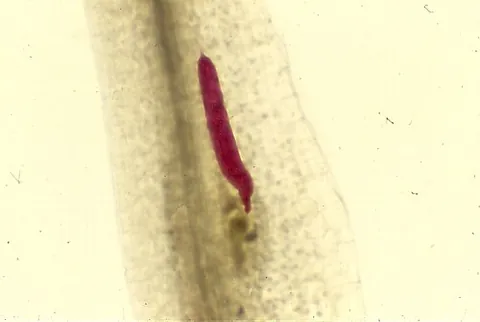 root-knot nematode: any nematode of the genus Meloidogyne, which parasitize the roots of various plants