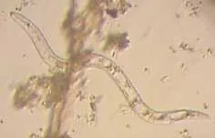 roundworm: an invertebrate animal of the phylum Nematoda and other similar phyla. Many species of roundworms...
