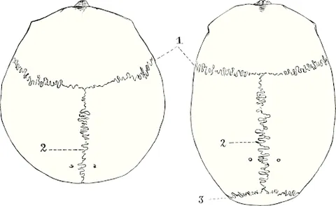 sagittal suture: a dense, fibrous connective tissue joint between the two parietal bones of the skull