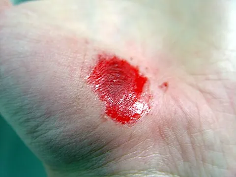 scrape: to draw (an object, especially a sharp or angular one), along (something) while exerting pressure