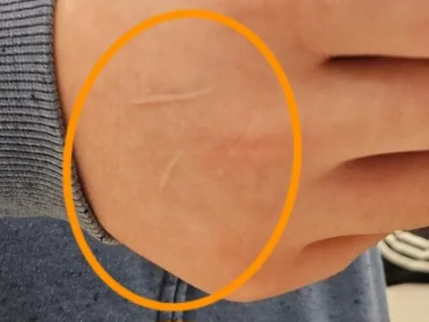 scratch: to rub a surface with a sharp object, especially by a living creature to remove itching with nails,...