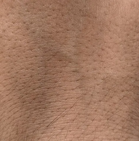 skin: the outer protective layer of the body of any animal, including of a human