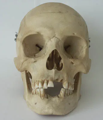 skull: the main bones of the head considered as a unit; including the cranium, facial bones, and mandible