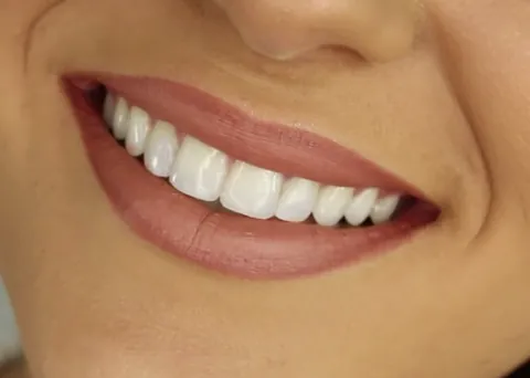 smile: a facial expression comprised by flexing the muscles of both ends of one's mouth, often showing the...