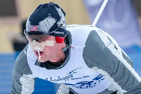 snotsicle: a solidly frozen trail of mucus from the nose