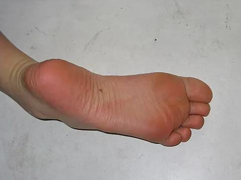 sole: only