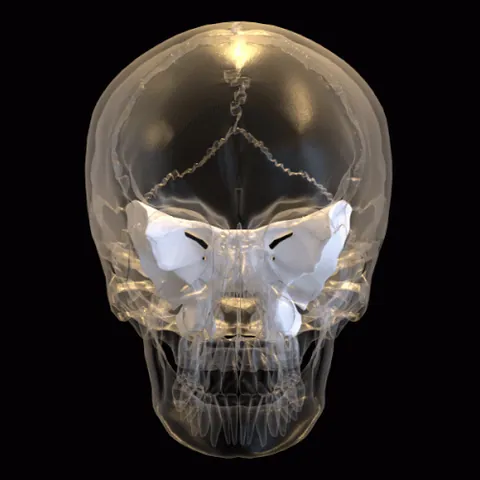 sphenoid bone: a compound bone at the base of the skull behind the eyes in humans and various other animals