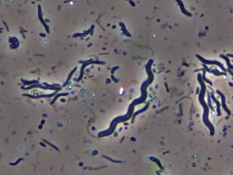 spirillum: any of various aerobic bacteria of the genus Spirillum, having an elongated spiral form and bearing...