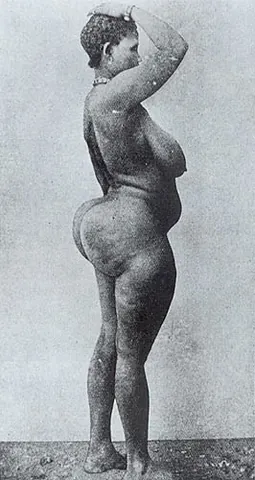 steatopygia: an excessive accumulation of fat on the buttocks