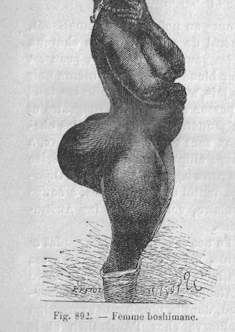 steatopygous: pertaining to steatopygia; having fat or prominent buttocks