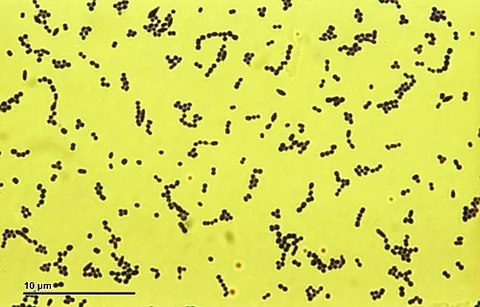 streptococcus: a spherical, gram-positive bacterium of the genus Streptococcus. Although commonly found benignly...