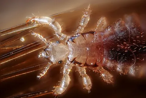 sucking louse: any louse of the suborder Anoplura