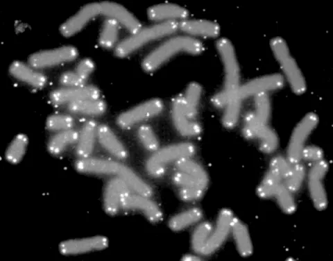 telomere: either of the sequences of DNA at each end of a eukaryotic chromosome