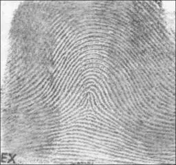 tented arch: a type of fingerprint pattern where ridges enter from one side, rise sharply in the center to form...