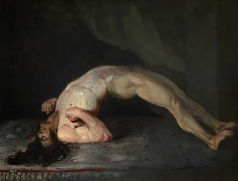 tetanus: a serious and often fatal disease caused by the infection of an open wound with the anaerobic...