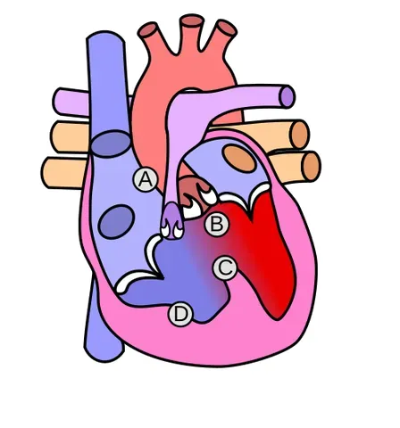 tetralogy of fallot: a congenital heart defect, characterised by the four findings of ventricular septal defect,...