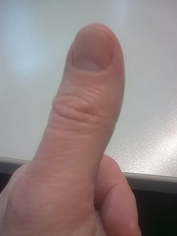 thumb: the shortest and thickest digit of the hand that for humans has the most mobility and can be made...