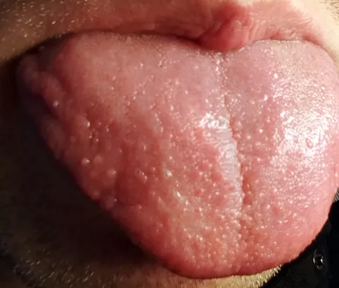 tongue: the flexible muscular organ in the mouth that is used to move food around, for tasting and that is...