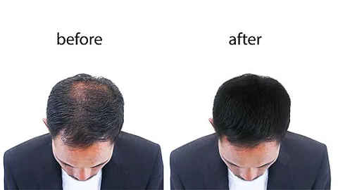 toupee: a wig of false hair worn to cover a bald spot, especially as worn by a man