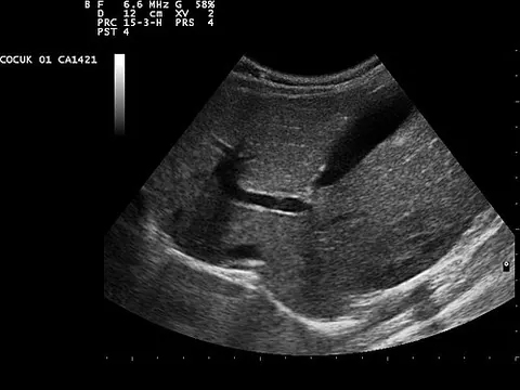 ultrasonography: medical ultrasonography: The use of ultrasound to produce diagnostic images of the internal organs...