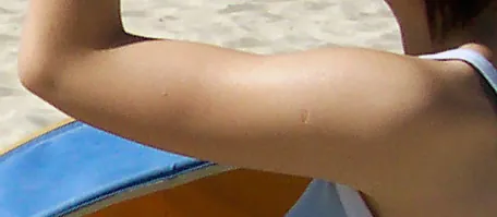 upper arm: the section of an arm from the elbow to the shoulder