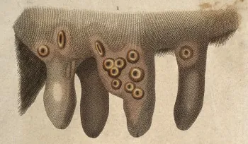 vaccinia: an infection of cowpox