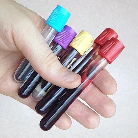 vacutainer: a glass or plastic test tube with a rubber stopper creating an internal vacuum, used to draw blood...