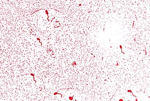 vibrio: any of several bacteria, of the genus Vibrio, shaped like a curved rod