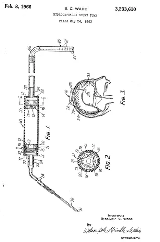 wade-dahl-till valve: a kind of cerebral shunt using two metal discs, each in a restrictive housing at the end of a tube,...