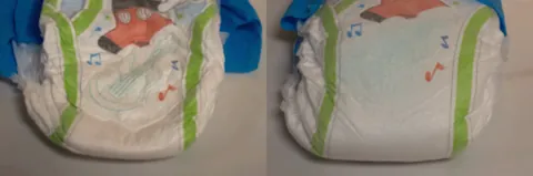 wetness indicator: a graphic on the rise (front) of a disposable diaper that fades or changes colour when the diaper...