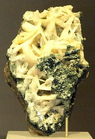 whitlockite: a rare form of calcium phosphate