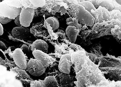 yersinia: a Gram-negative bacterium, of the genus Yersinia, that is an etiological agent of several diseases...