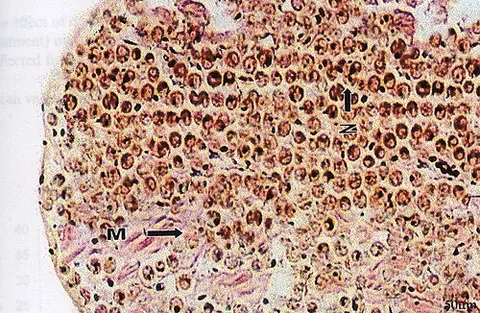 zooxanthellan: any of a group of dinoflagellates of the zooxanthellae, represented by genus Symbiodinium and its...