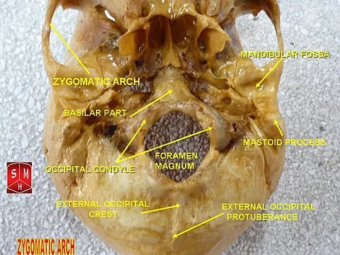 zygomatic arch: an arch formed by the zygomatic process of the temporal bone and the temporal process of the...