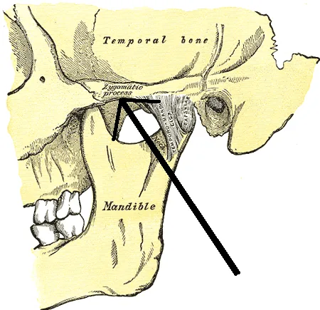 zygomatic process: a protrusion from the rest of the skull, most of it belonging to the zygomatic bone, but also...