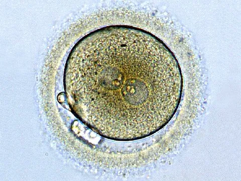 zygote: a eukaryotic cell formed from the fusion of two gametes (“reproductive cells”) during a...